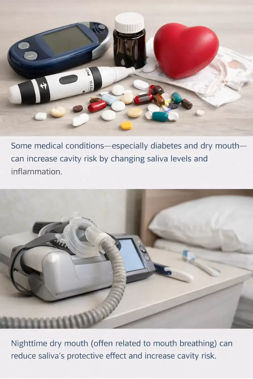 Nighttime dry mouth and cavity risk Nighttime dry mouth from mouth breathing can increase cavity risk
