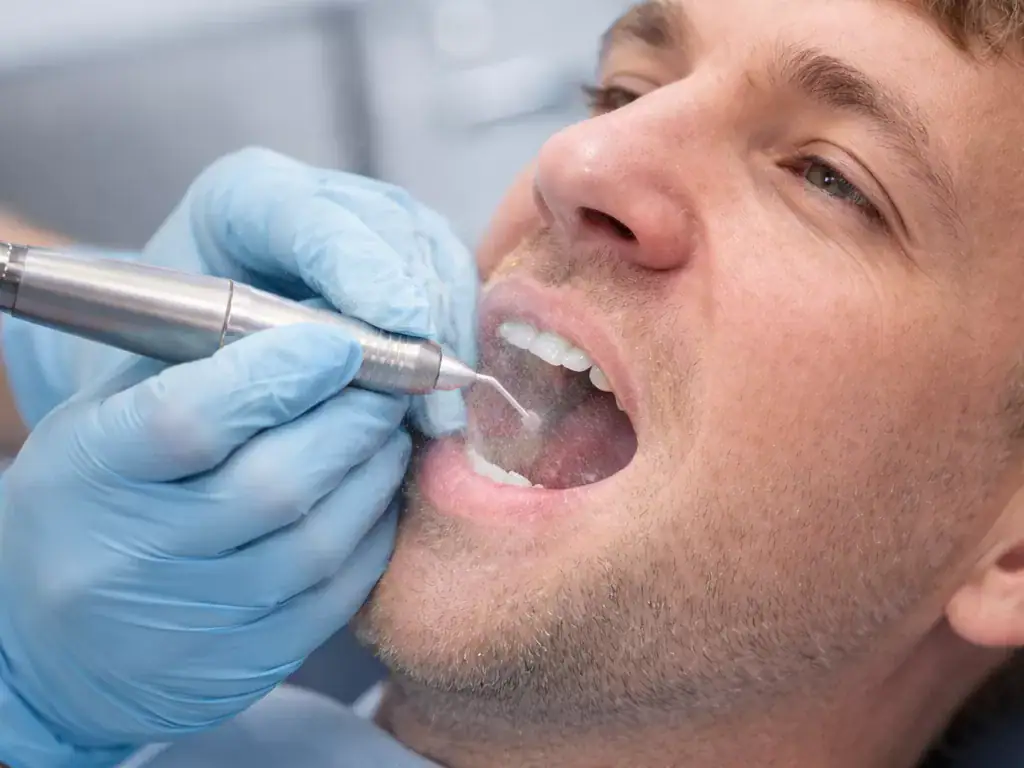 Professional dental cleaning with ultrasonic scaler Dental hygienist performing a professional cleaning with an ultrasonic scaler